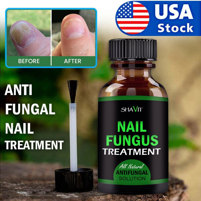 ANTI FUNGAL TREATMENT EXTRA STRENGTH TOENAIL FUNGUS ATHLETES FOOT FUNGI NAIL - Kannabliss Exotics