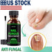 ANTI FUNGAL TREATMENT EXTRA STRENGTH TOENAIL FUNGUS ATHLETES FOOT FUNGI NAIL - Kannabliss Exotics