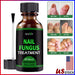 ANTI FUNGAL TREATMENT EXTRA STRENGTH TOENAIL FUNGUS ATHLETES FOOT FUNGI NAIL - Kannabliss Exotics