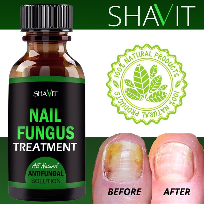 ANTI FUNGAL TREATMENT EXTRA STRENGTH TOENAIL FUNGUS ATHLETES FOOT FUNGI NAIL - Kannabliss Exotics