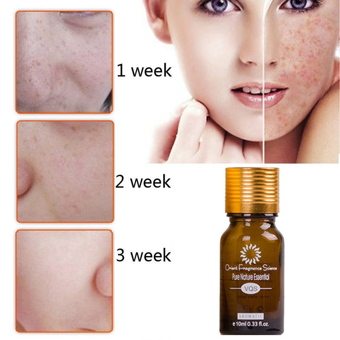 Dredge Meridian Skin Care Natural Pure Removal Acne Stretch Marks Scar Removal Essence oil - Kannabliss Exotics