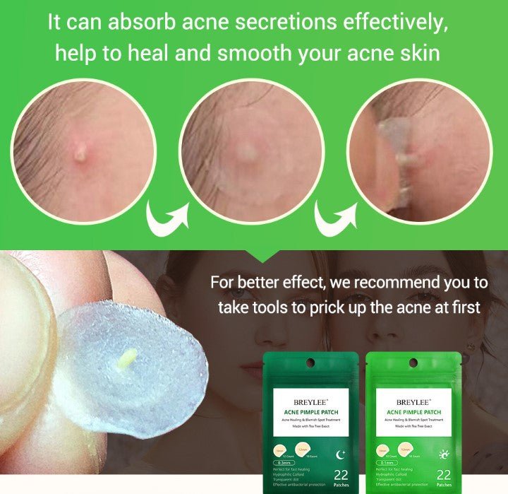 Tea Tree Acne Patch Fades Acne Marks and Ultra - thin - Kannabliss Exotics