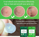 Tea Tree Acne Patch Fades Acne Marks and Ultra - thin - Kannabliss Exotics